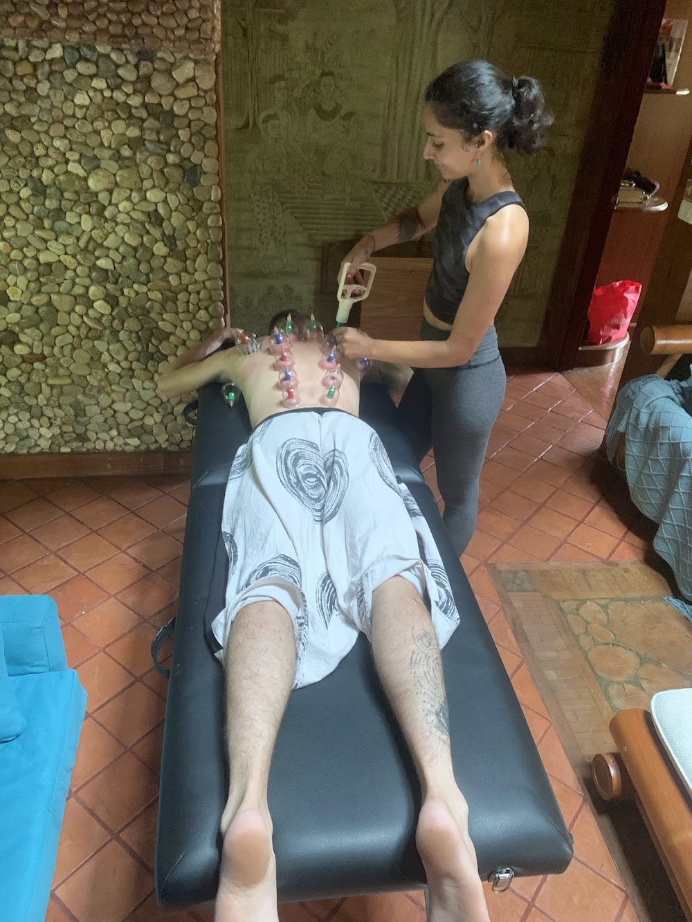 chinese cupping treatment in salinas ca